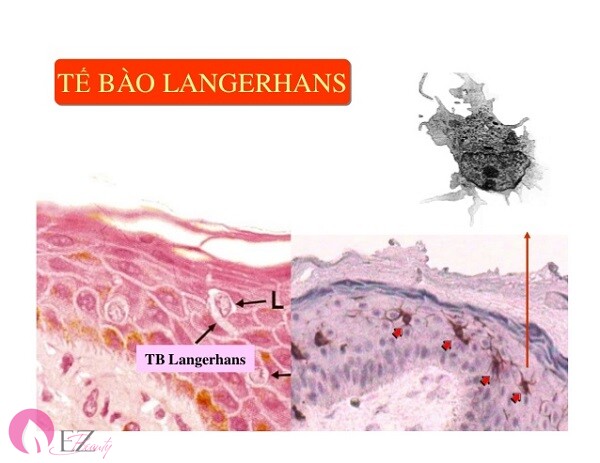 Tế bào Langerhans bên trong lớp gai của biểu bì