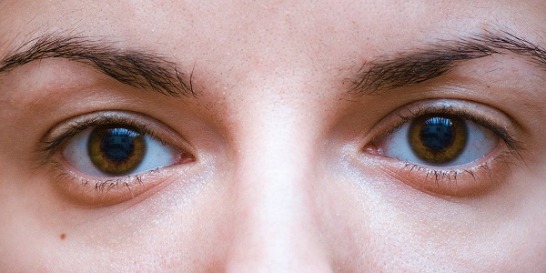 Vùng da mắt sẽ dần bị lão hóa nếu không chăm sóc đúng cách