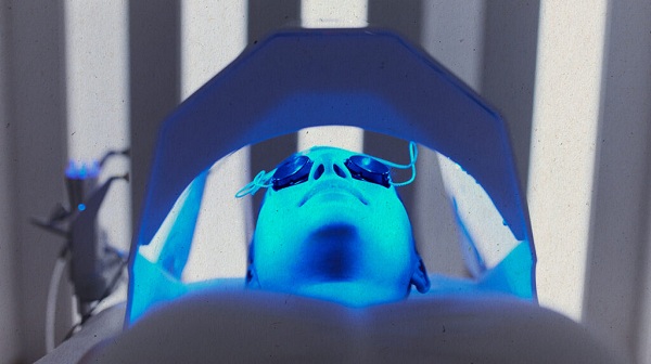 Sử dụng công nghệ bluelight trong trị mụn khi mang thai