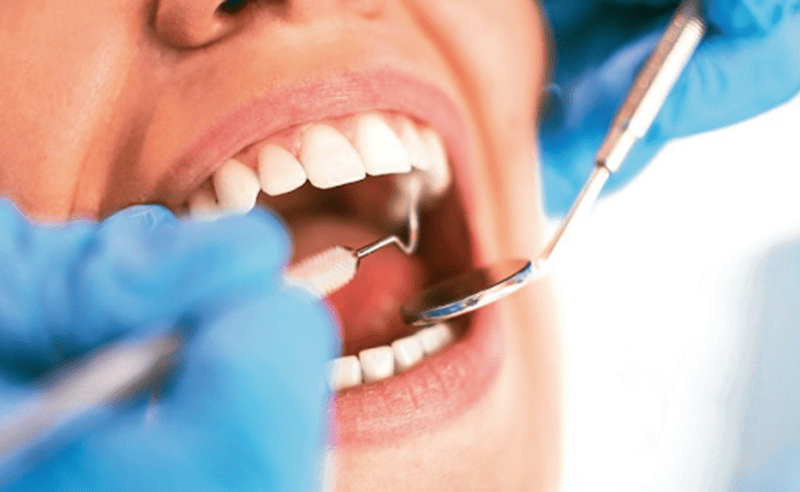 Nha khoa quốc tế á châu – địa chỉ tin cậy cho việc nhổ răng khôn