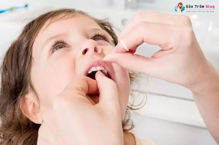 Cách chăm sóc răng miệng cho trẻ theo từng giai đoạn 6