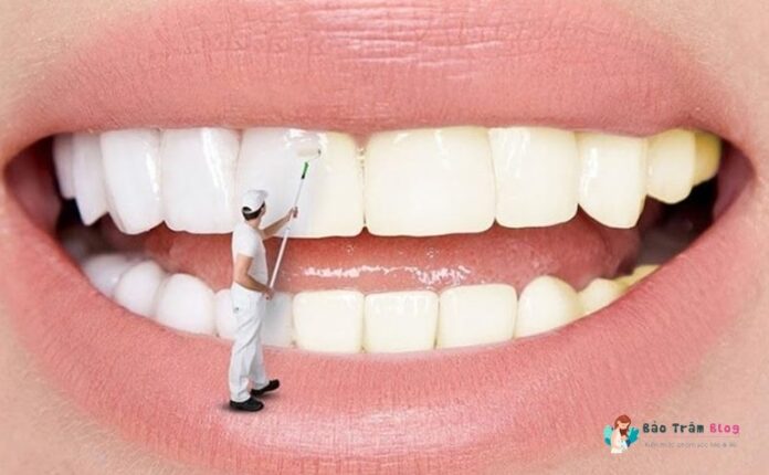Răng bị ố vàng phải làm sao?