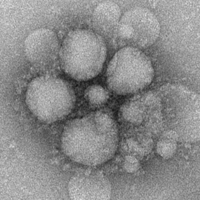 Các triệu chứng đặc biệt để nhận biết nhiễm Coronavirus (Covid-19)